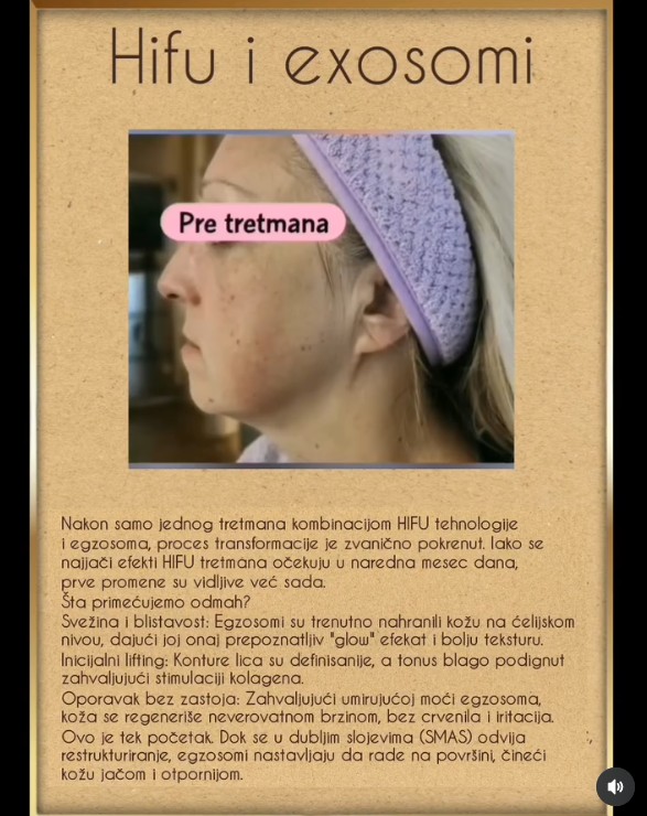 Egzosomi su trenutno najveći “bum“ u regenerativnoj medicini. Foto: Prtscrn Instagram/@antiagingnikcevic